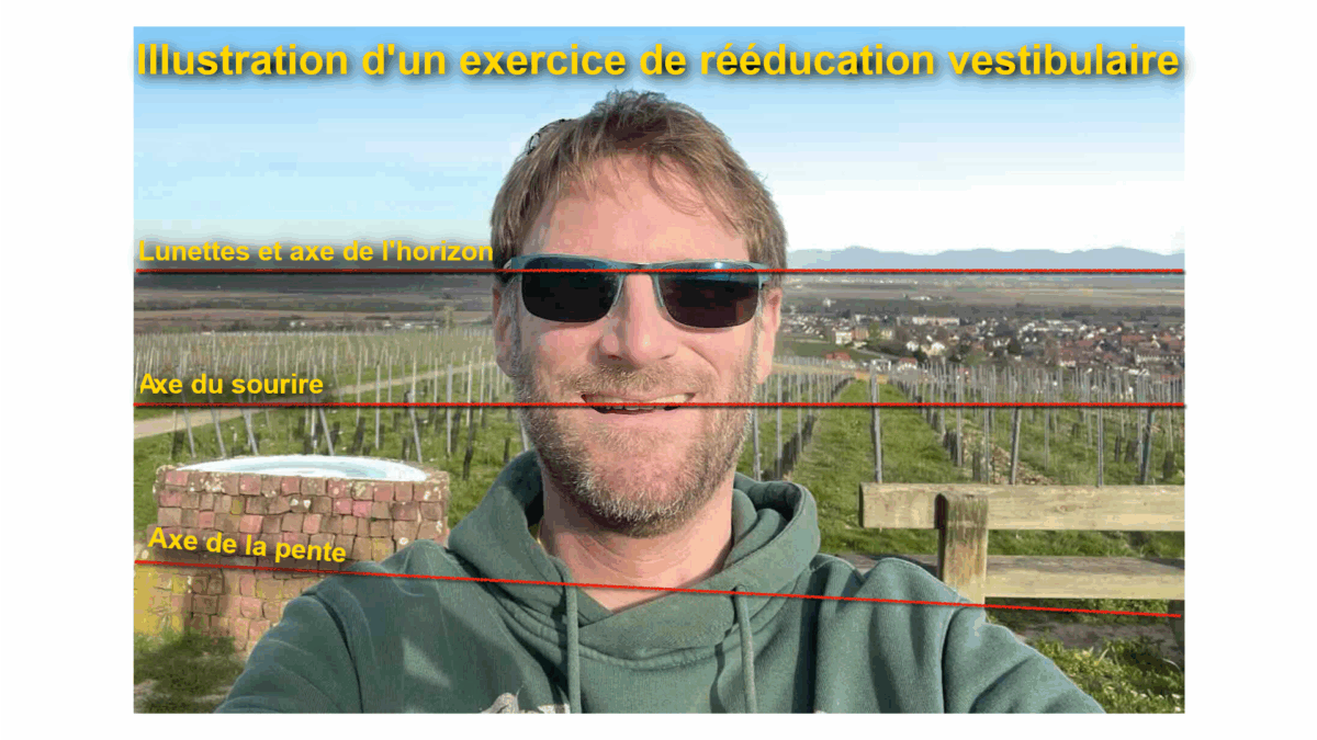 Rééducation Vestibulaire, Patrick Millan